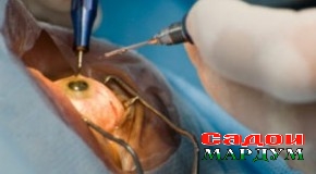 Чашмамро духтур кӯр кард